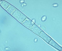 Cercospora zeae-maydis spore