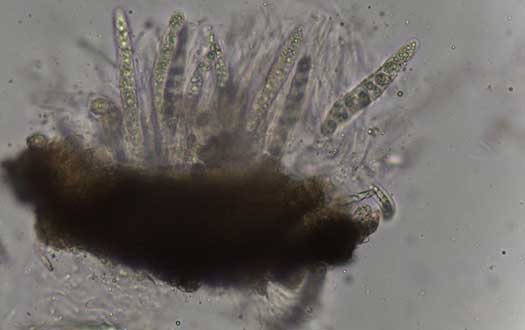 Microscopic view of fungal spores of tar spot.