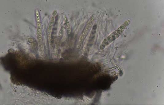 Photo - Corn leaf under magnification showing dense coverage with tar spot ascomata.