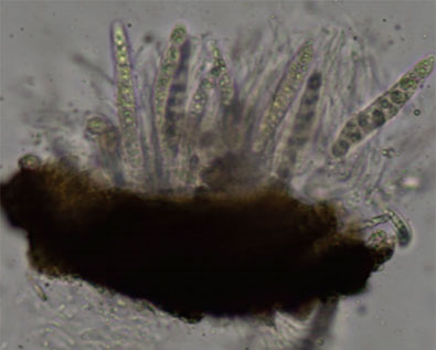 Photo - Microscopic view of fungal spores of  tar spot.