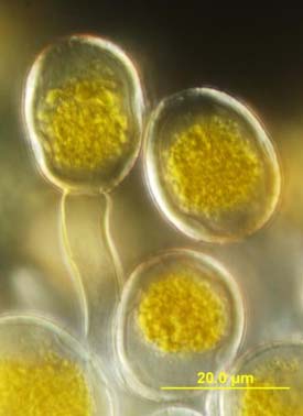 Photo - cloesup - wheat leaf rust pathogen spores.
